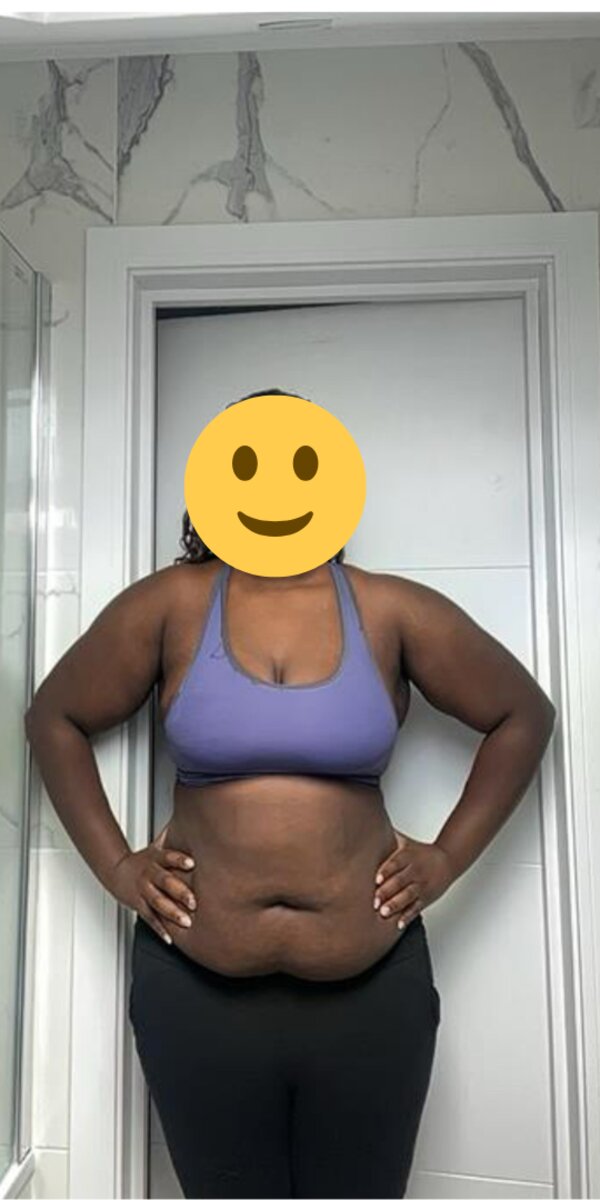 Josi before her transformation