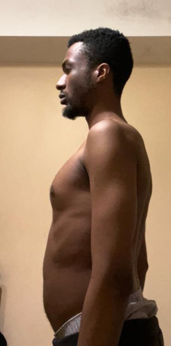Obinna before his transformation